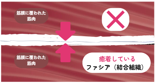 筋膜リリース | あしやはま整骨院 | 筋膜リリース専門